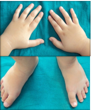 Small hands and feet.