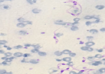 Bovine Trypanosomiasis: Retrospective Investigation and Clinical Signs