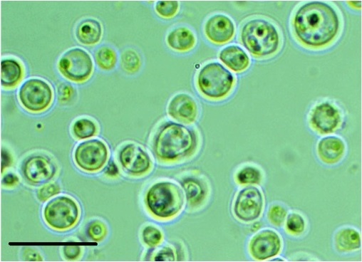: Microscopic picture of the microalga