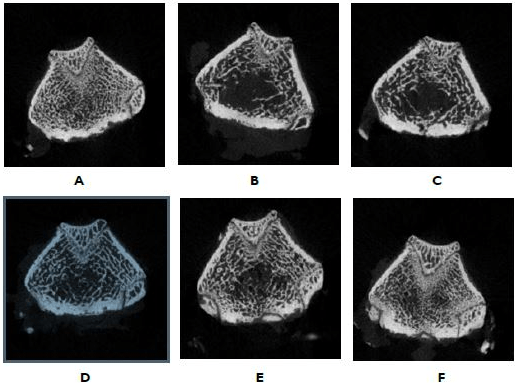 Micro-Computed Tomography Analysis of the Femora