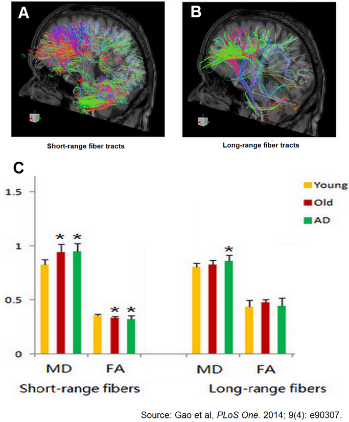 Tractography demonstrations of ROI from fMRI data