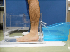 The Effects of Hyperbaric Oxygen Therapy on Reduction of Edema and Pain in Athletes With Ankle Sprain in the Acute Phase: A Pilot Study
