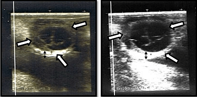 Determination of Ovarian Cysts in Cattle with Poor Reproductive Performance Using Ultrasound and Plasma Progesterone Profile